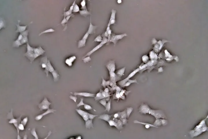 Living cells, phase contrast