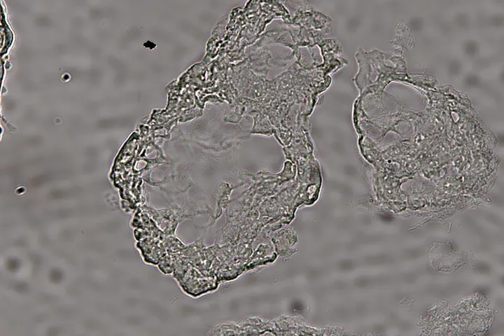 Unstained placental organoids, bright-field