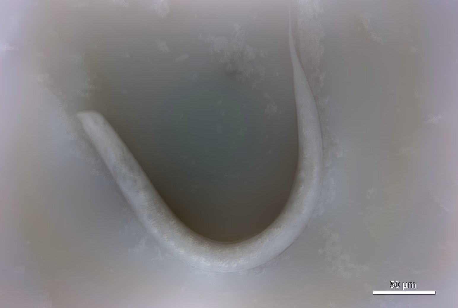 Quantitative phase image of the same nematode