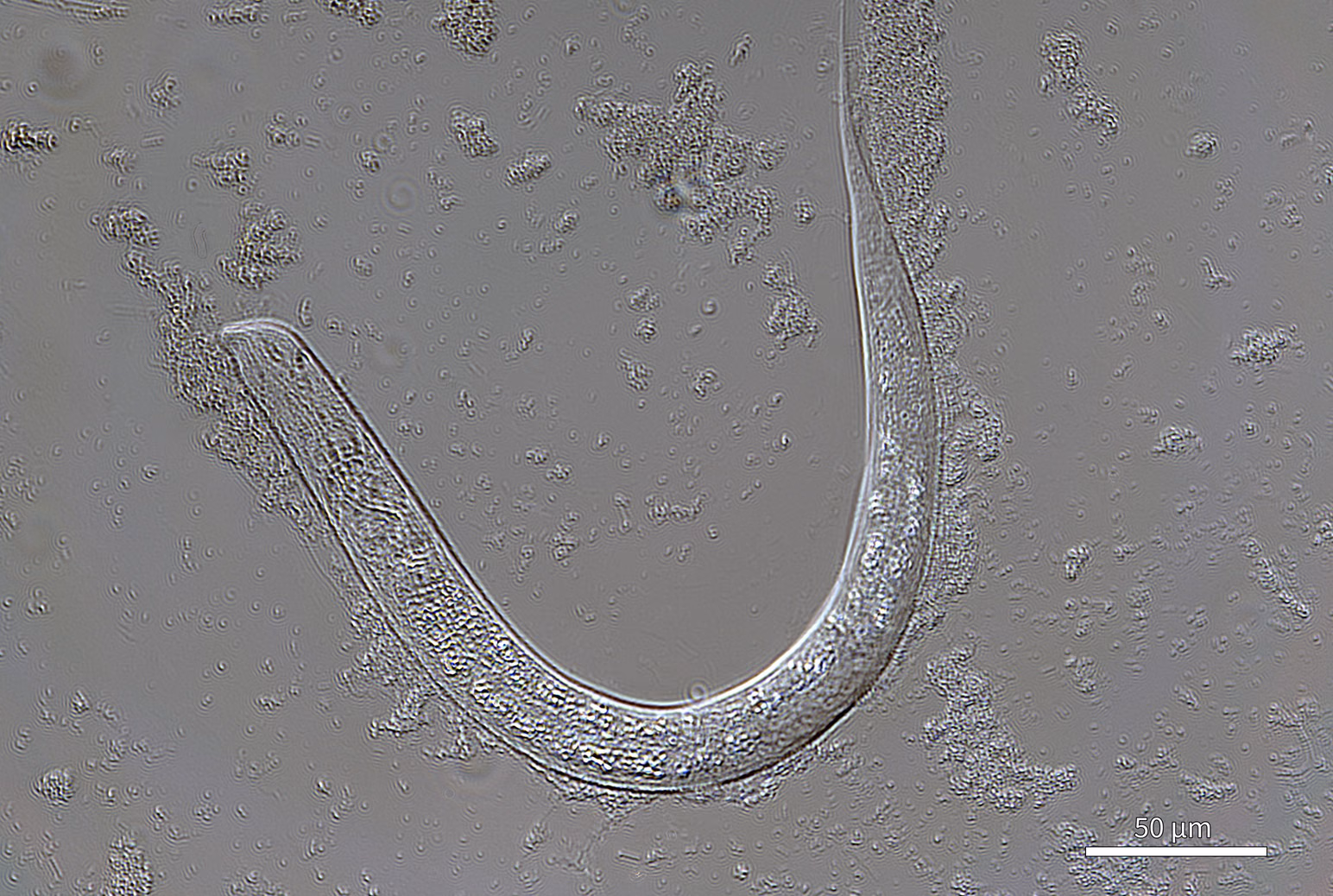 DIC image of the same nematode
