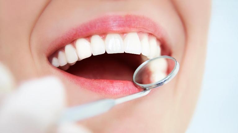 Dental Cleanings Encinitas CA