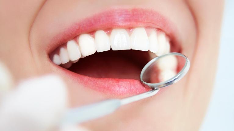 Cosmetic Dentistry in Encinitas CA