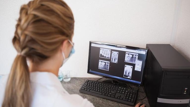 Digital Dental X-Rays in Encinitas CA