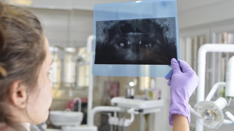 Tooth Replacement Encinitas CA