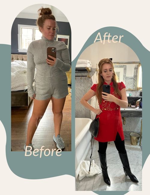 fat removal in Charlotte, NC, weight loss, medical weight loss