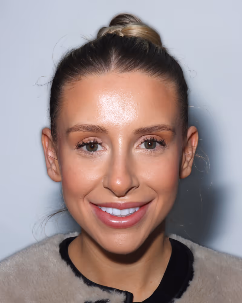 Invisalign and Whitening