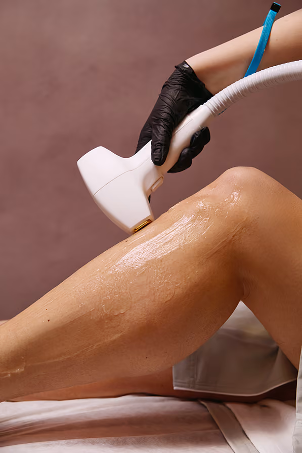 Laser hair removal treatment on a leg at TGB Spa Brighton