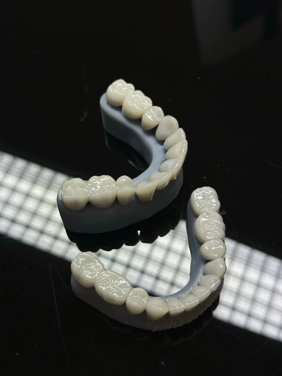 dentures-birmingham-al-full-arch-ceramic-teeth-on-dental-models