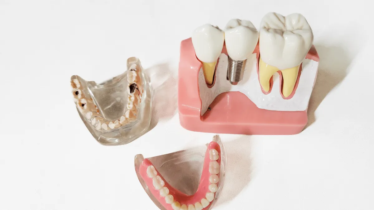 proces-osteointegracji-implantu
