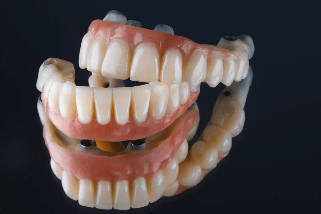proteza-overdenture-leczenie-bezzebia