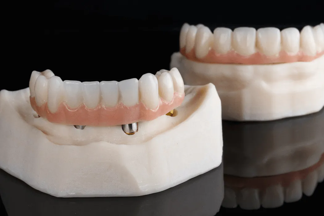 proteza-overdenture-na-implantach
