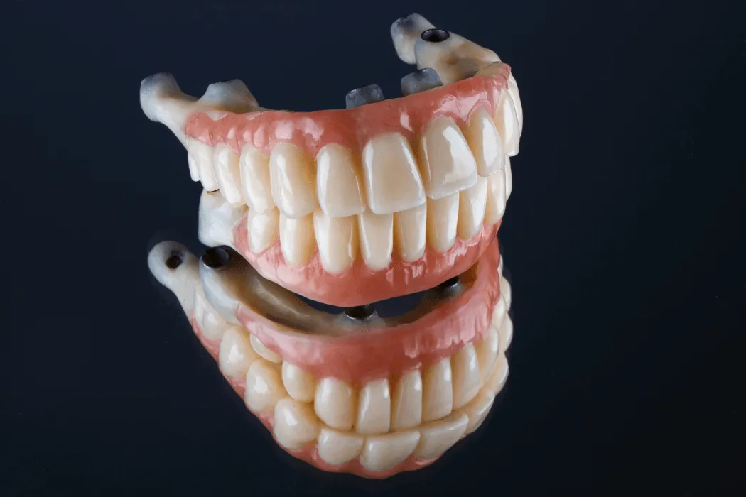 proteza-overdenture-stabilizacja-na-implantach