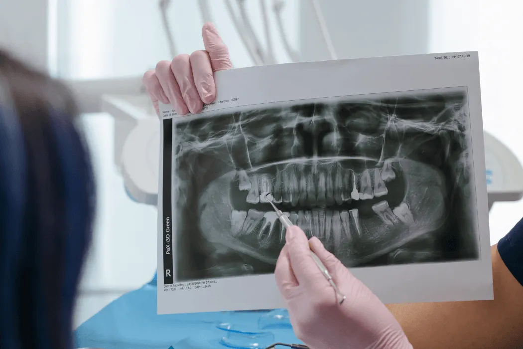 tomografia-komputerowa-przed-implantacja-zeba