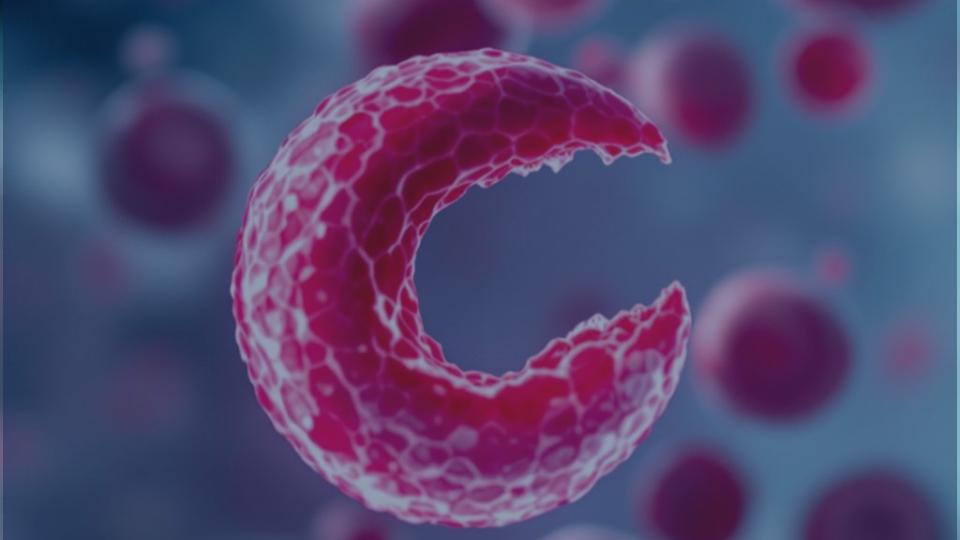 Illustration einer Sichelzelle