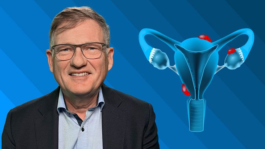 Expertenrunde Endometriose