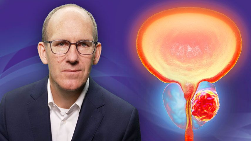 Experte Prostatakrazinom