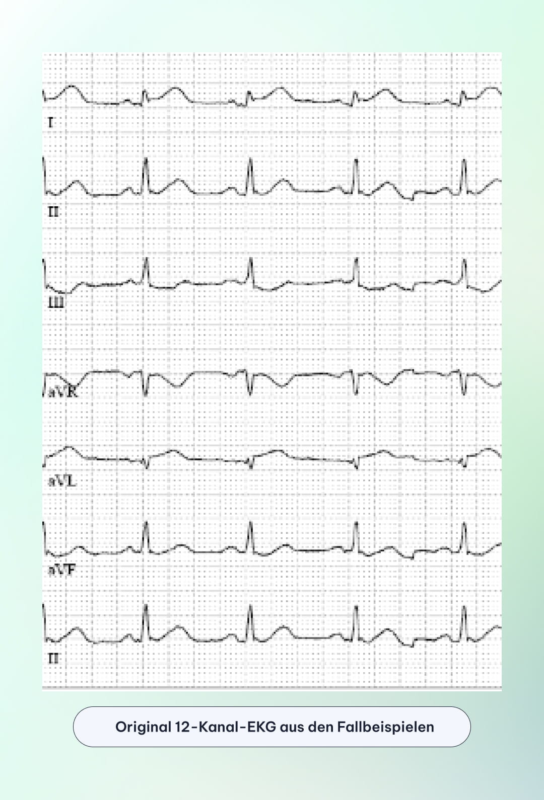 Fünf lächelnde medizinische Fachkräfte in verschiedenen Settings, darunter Ärzte und Krankenschwestern mit Stethoskopen.