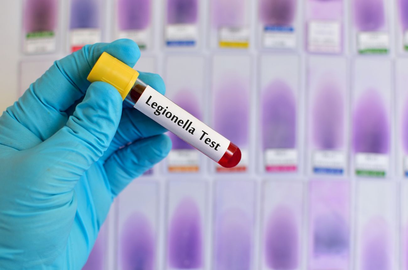 Prueba de legionella de bactaerias sustraídas de una torre de refrigeación