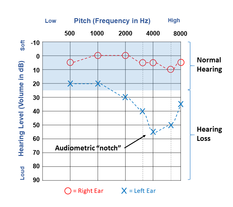 An example of an audiogram taken from NIOSH