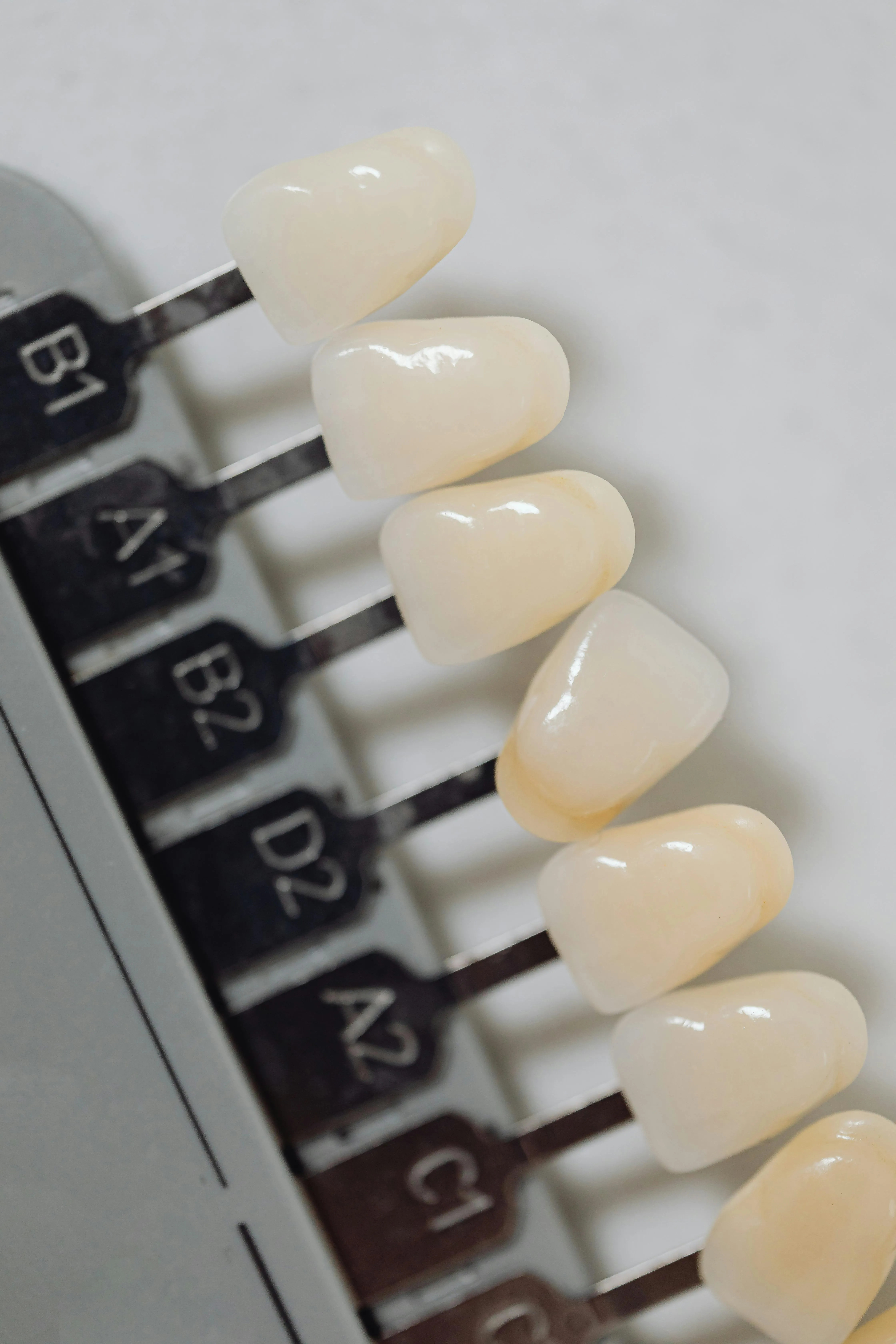 Close-up of a dental shade guide showing multiple tooth color samples used to match natural tooth shades for cosmetic dentistry and restorations.