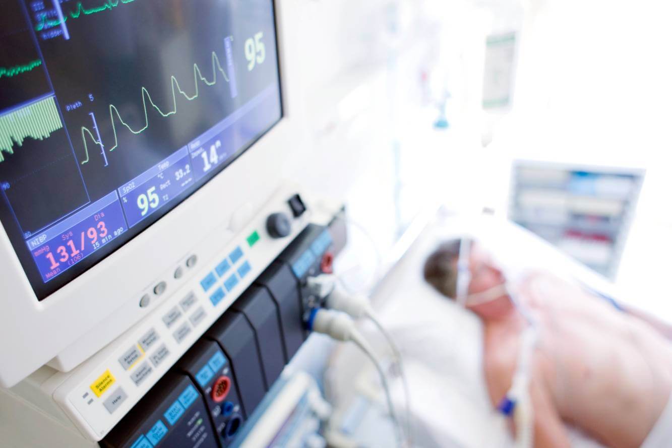 hospital room with monitors and man with a breathing tube inserted laying in bed incapacitated