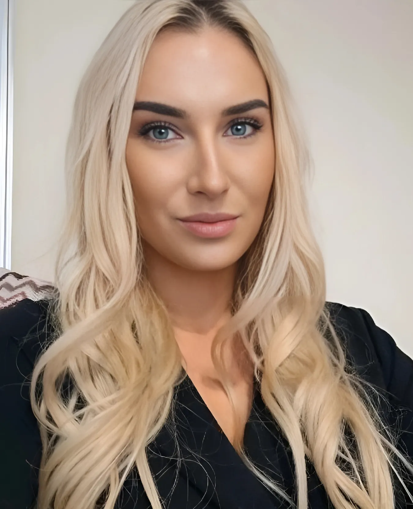Grazina Urboniene, Head of Marketing at Era Esthetic, facing camera with a neutral expression, long blonde hair, wearing a dark blouse.