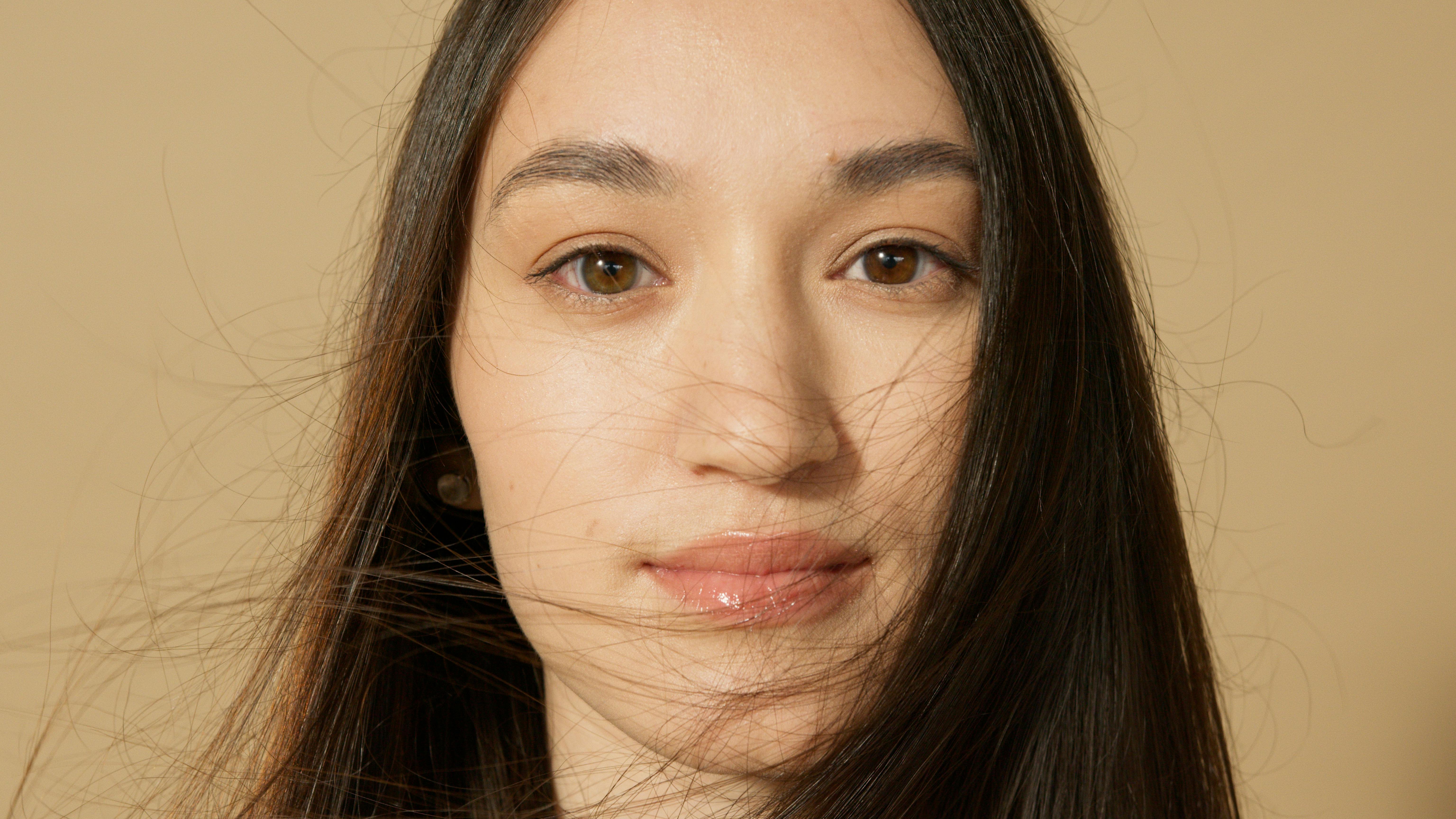 Kybella for Submental Fat (Double Chin)