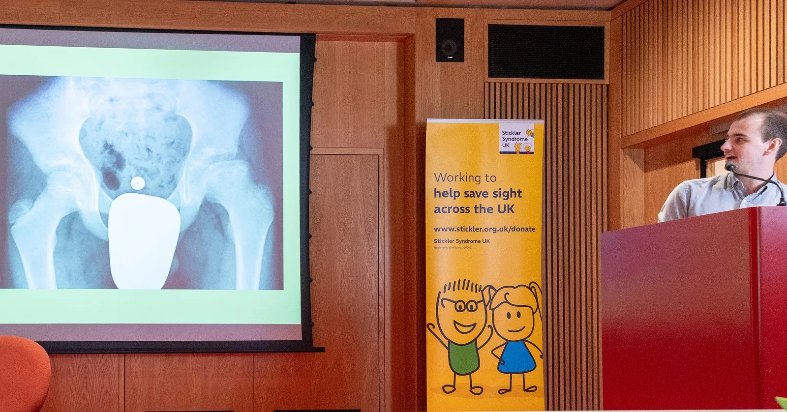 Perthes disease research talk at 2024 Conference