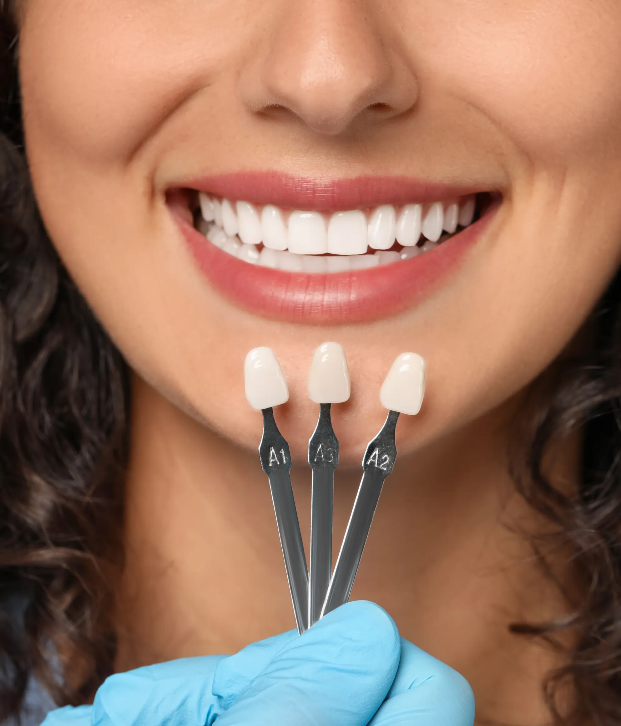 Close-up of a smiling woman showing white teeth with three dental shade guide samples held nearby by a gloved hand.