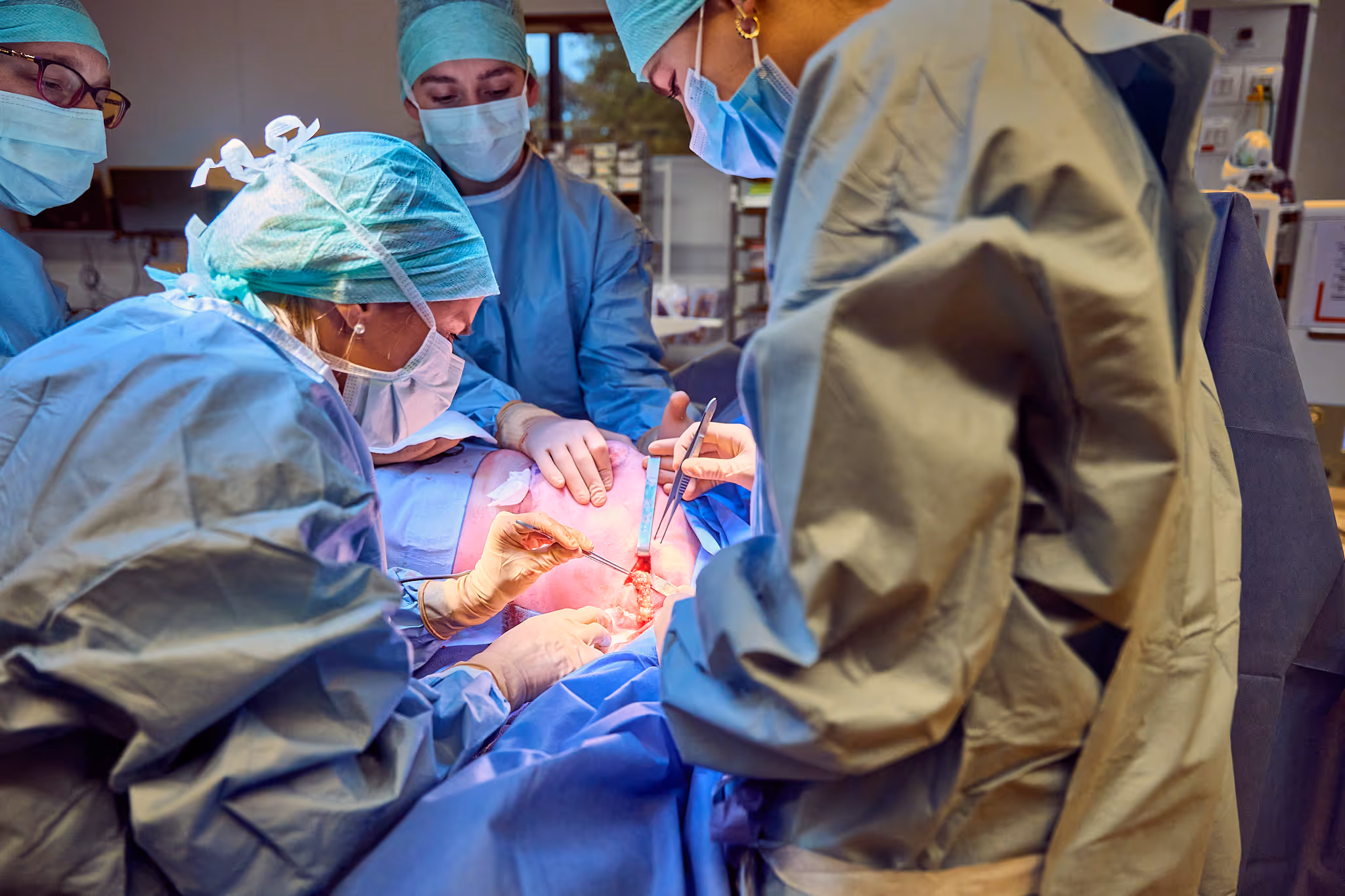 Chirurgisch team voert nauwkeurige borstoperatie uit in operatiezaal