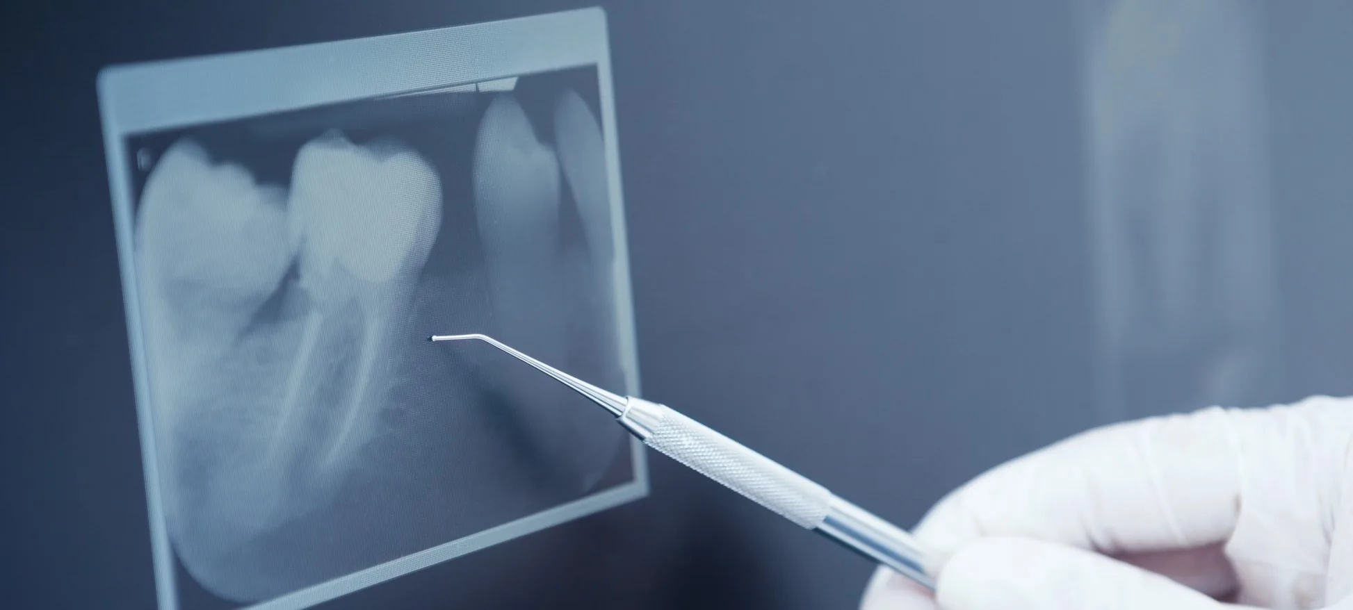 dental x-rays in Guilford, CT