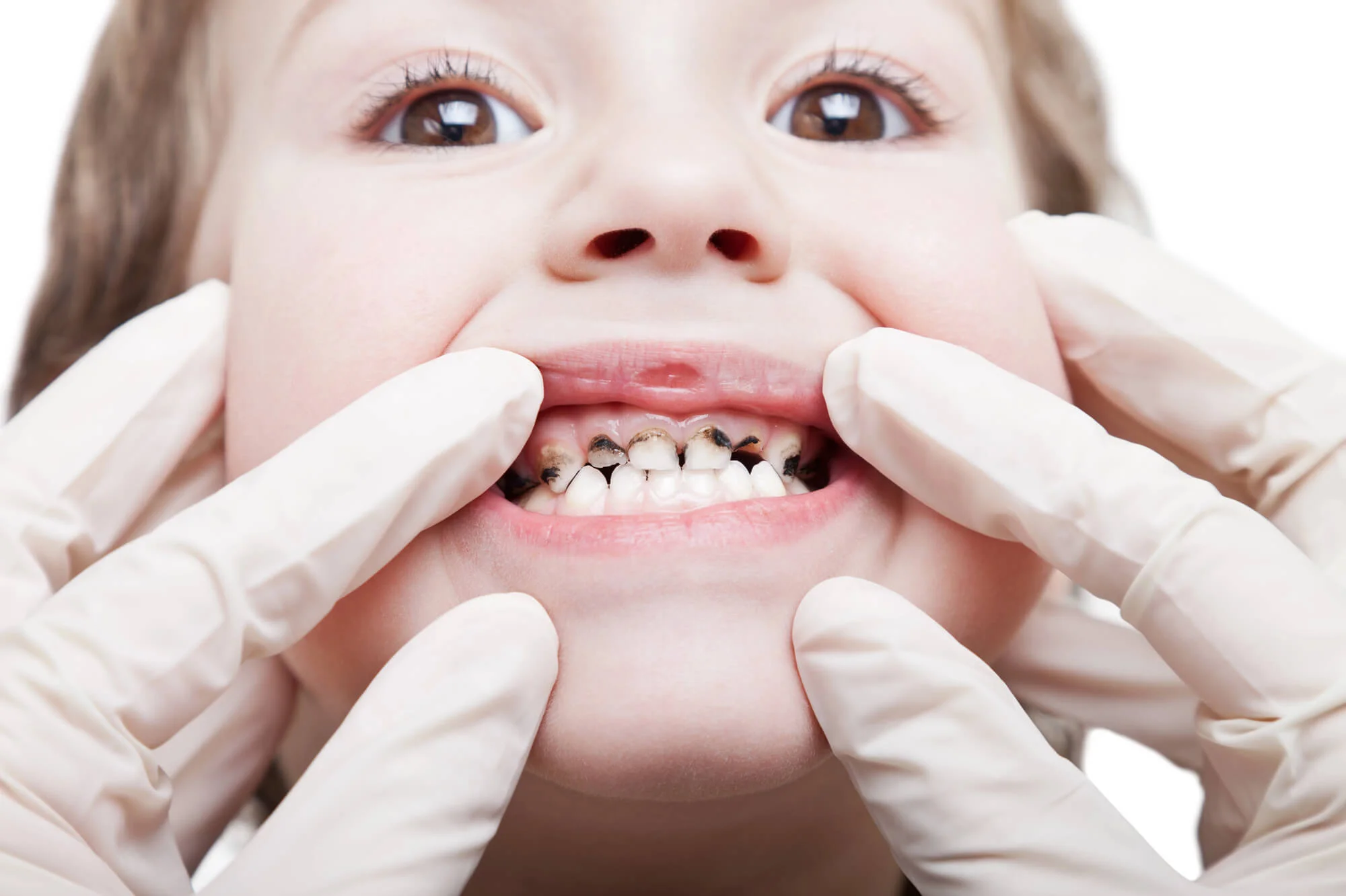 General Dentist in Branford CT checking teeth