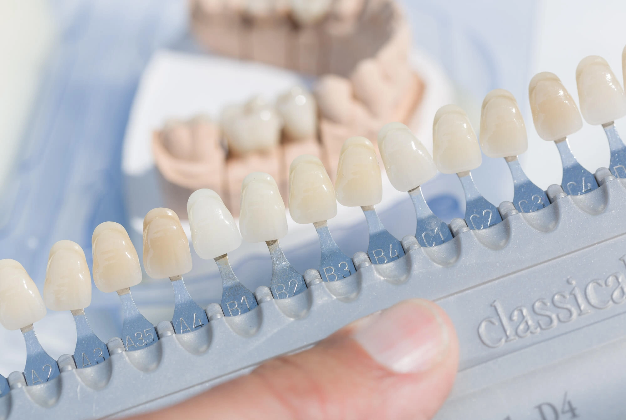 Veneers Shoreline CT