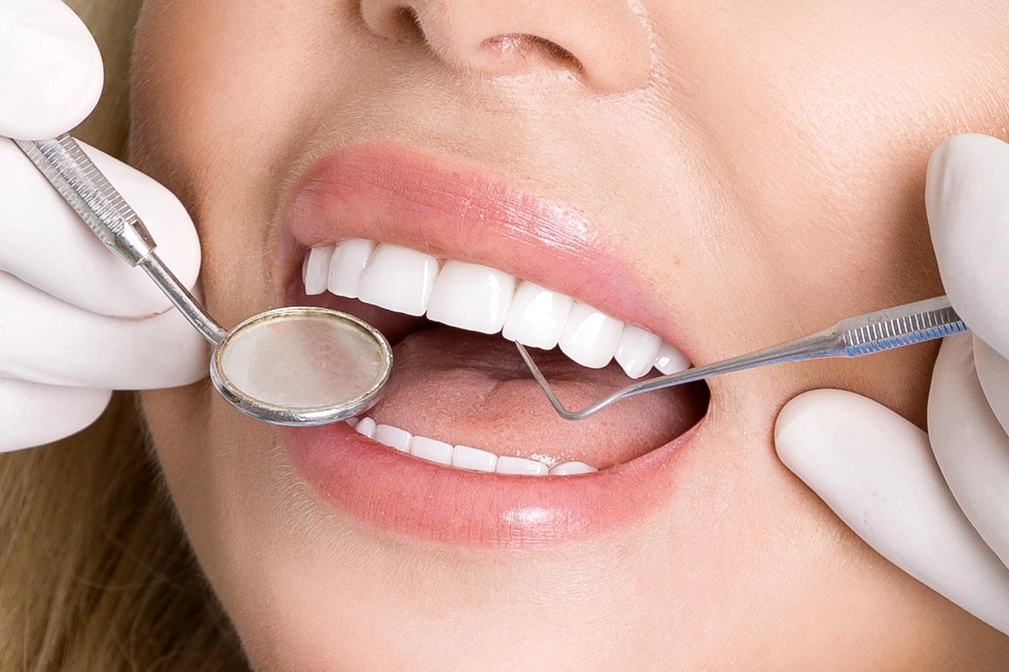 Woman with Veneers Shoreline CT