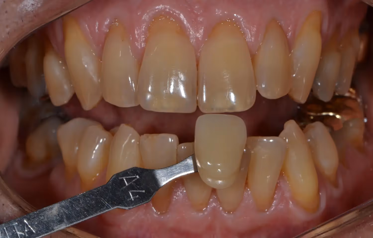 Before Image