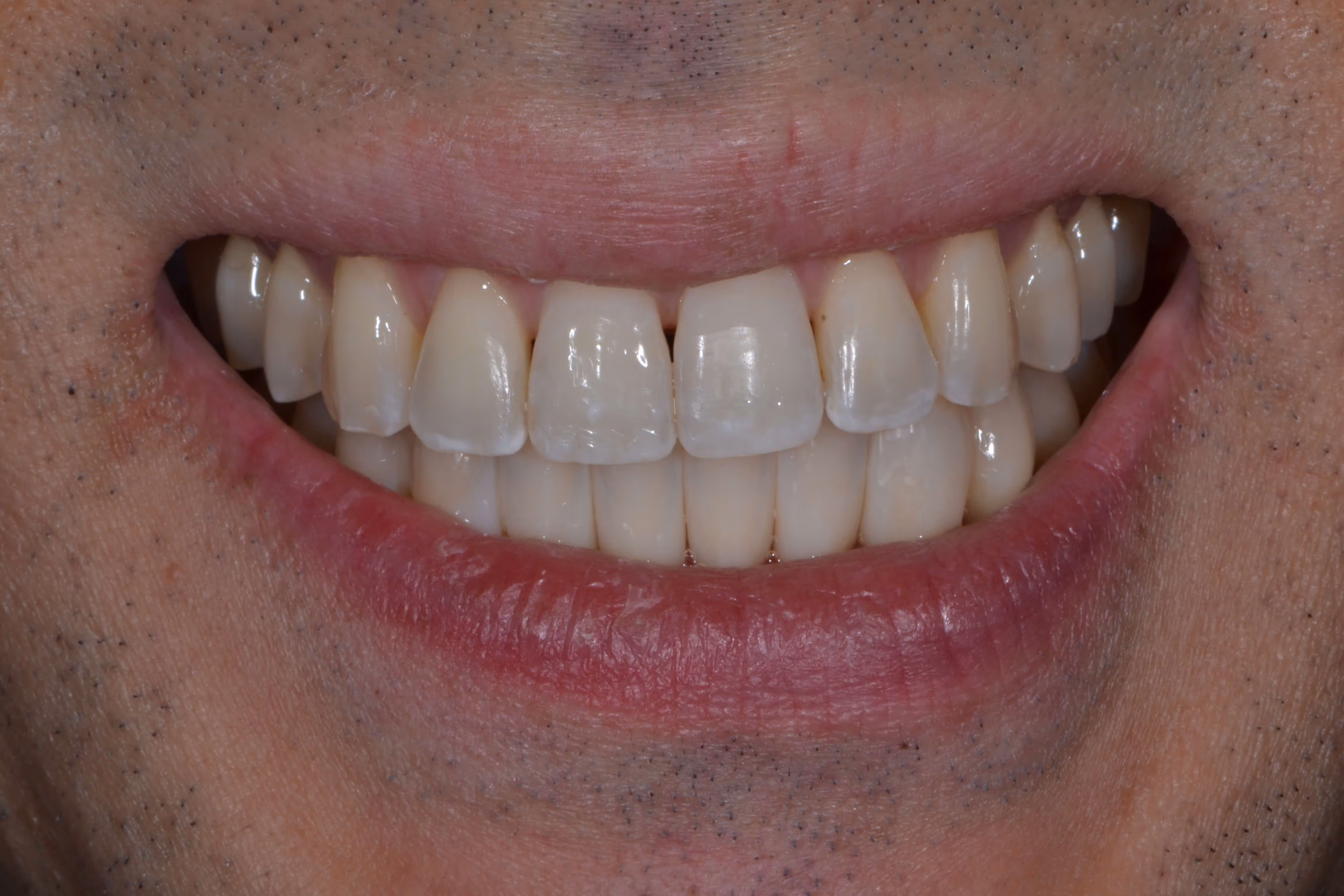Before Image