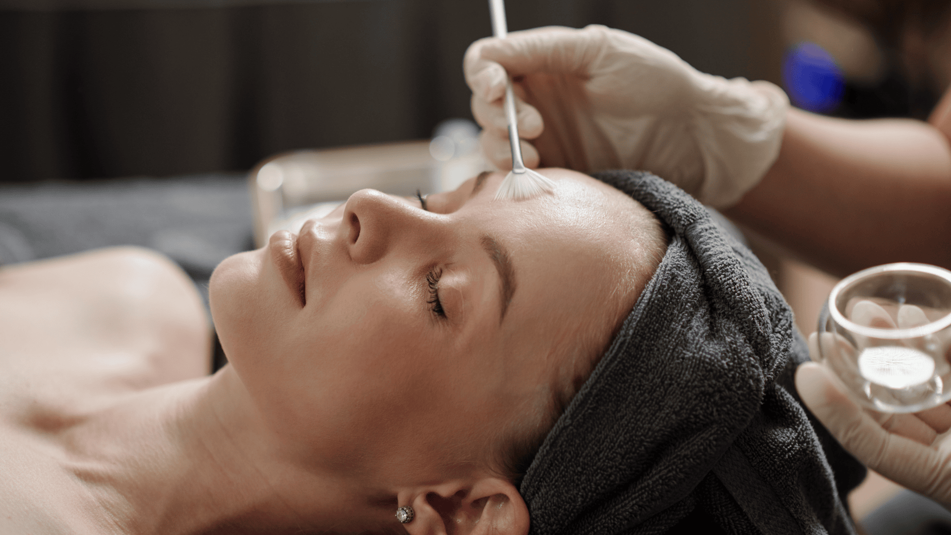 Chemical peels for hyperpigmentation: your complete guide!