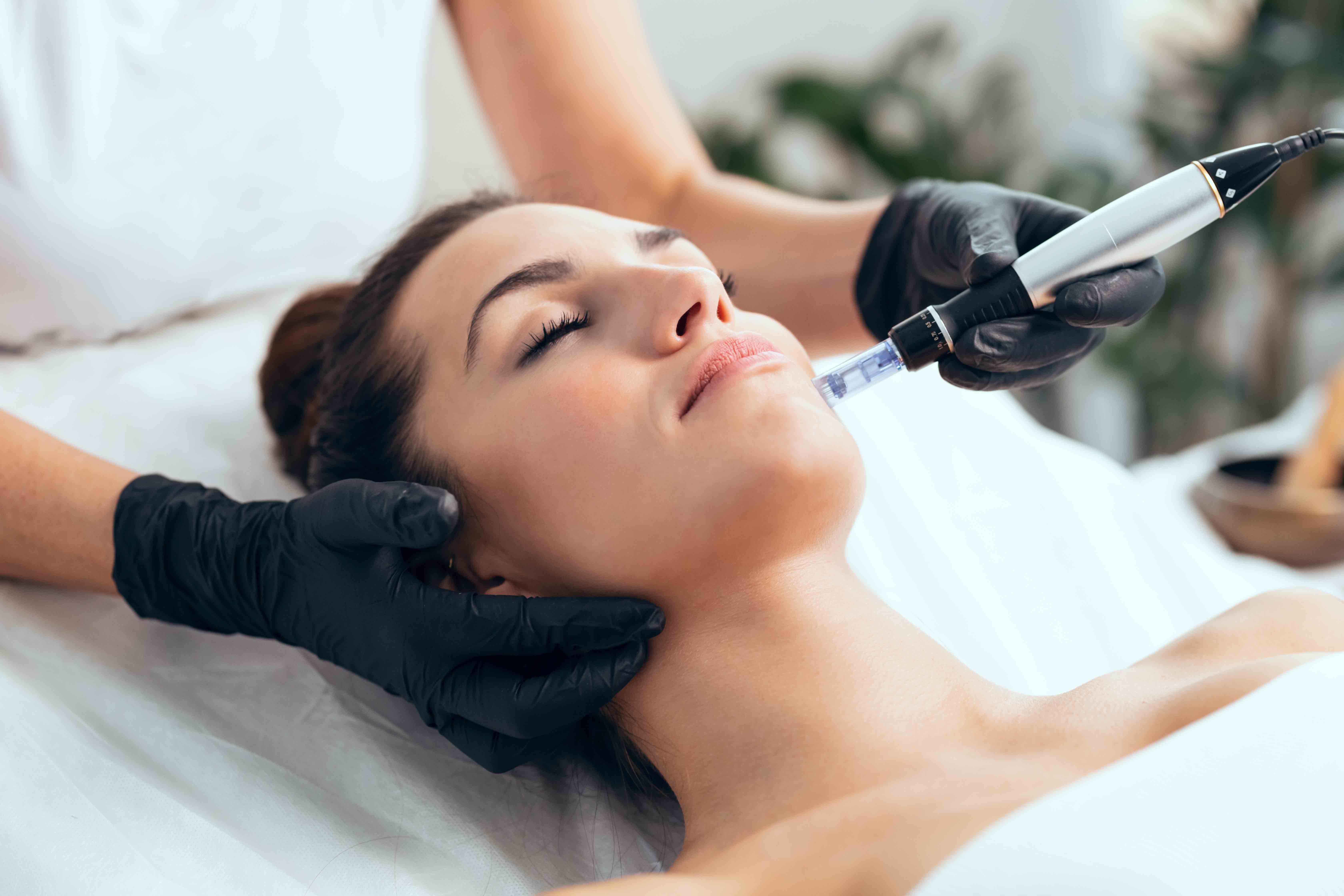 Microneedling 101: what it is, who it’s for, and why it works
