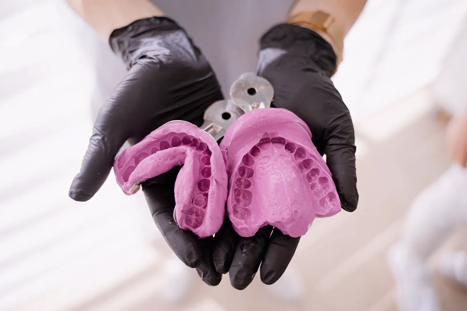 Dental Impressions