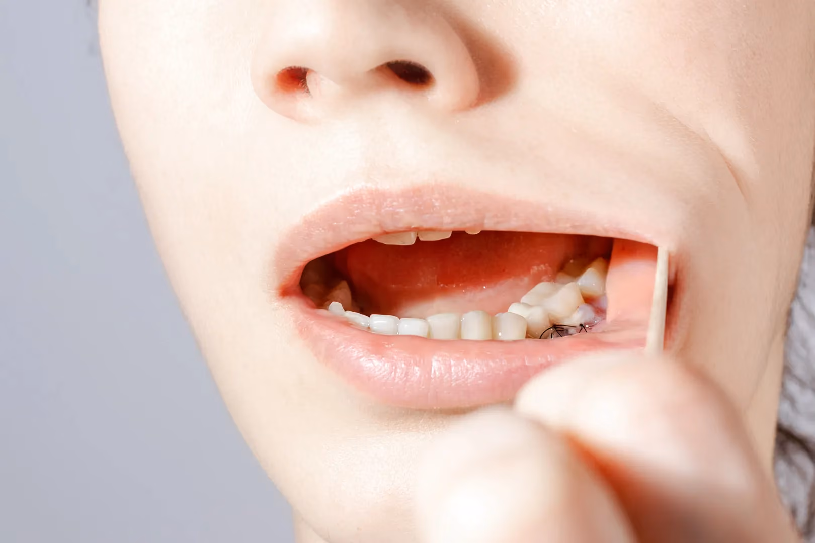 Gum Grafting