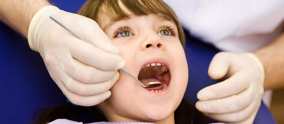 Fissure Sealing In Children