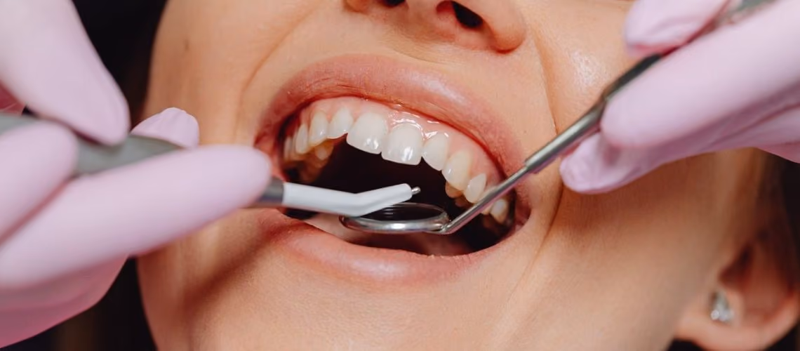 How to Get Rid of Swollen Gums