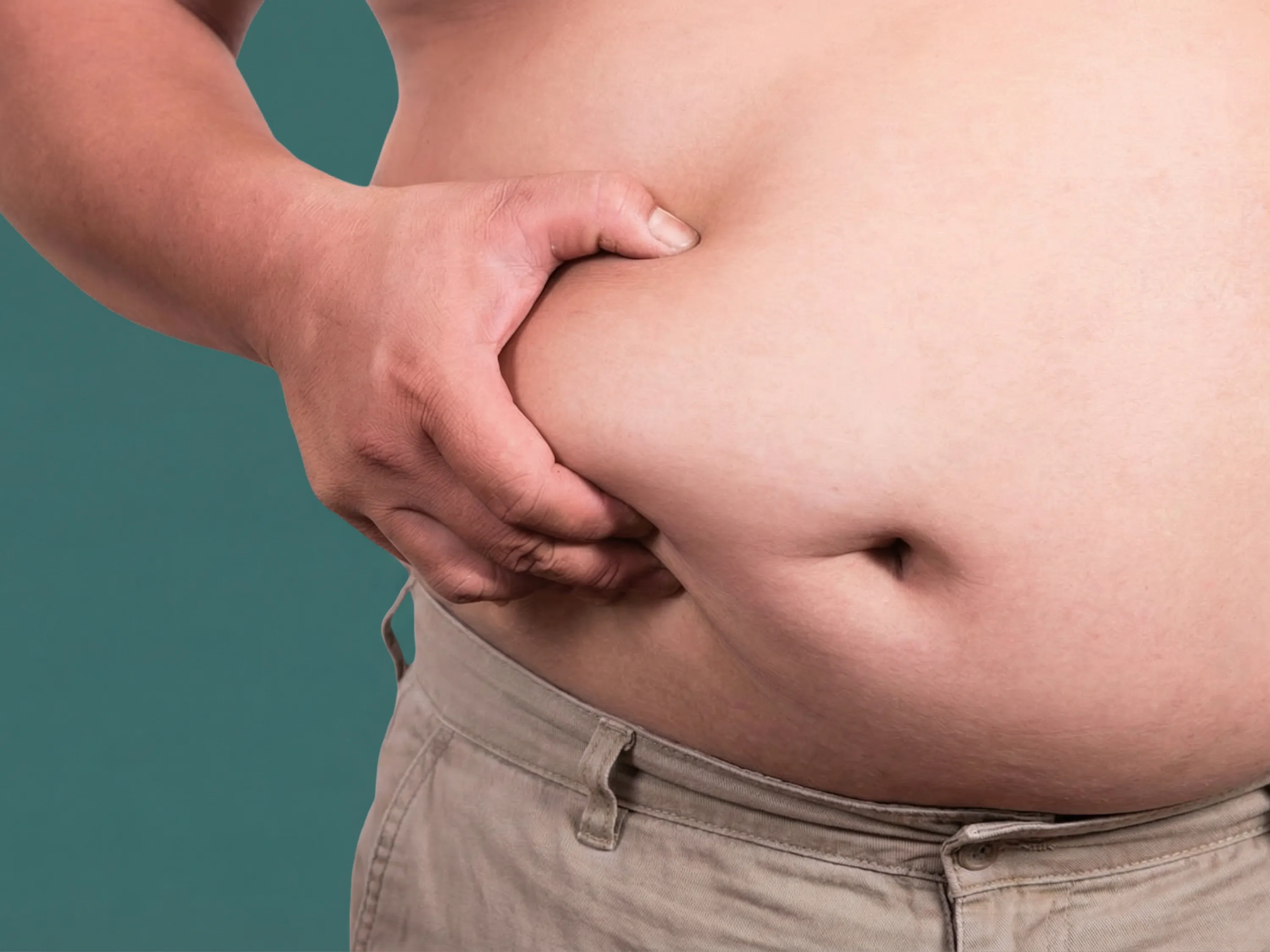 Subkutanes Fett am Bauch wird mit der Hand gegriffen