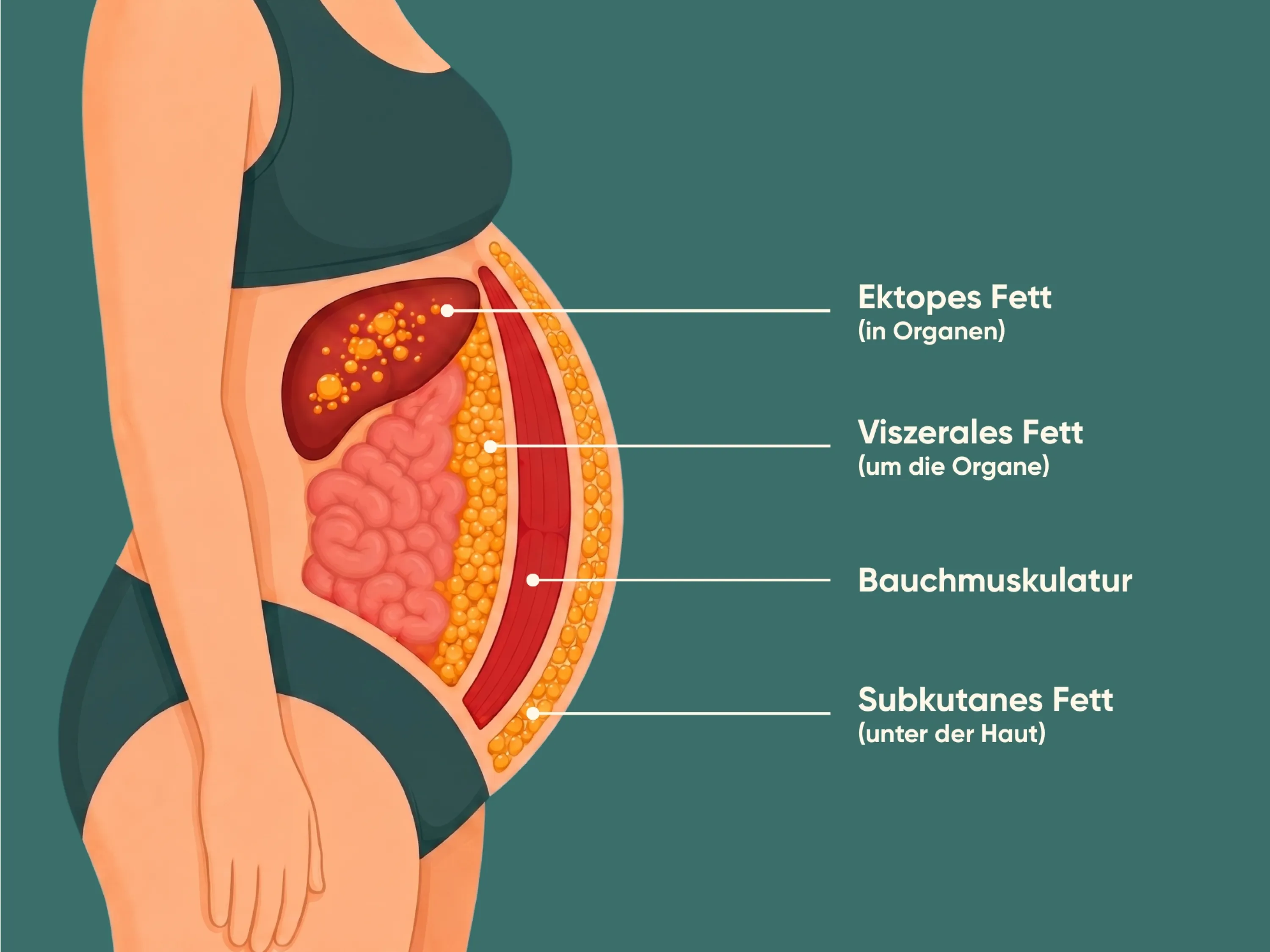 Abnehmen am Bauch: Grafik zeigt viszerales und subkutanes Bauchfett verständlich.
