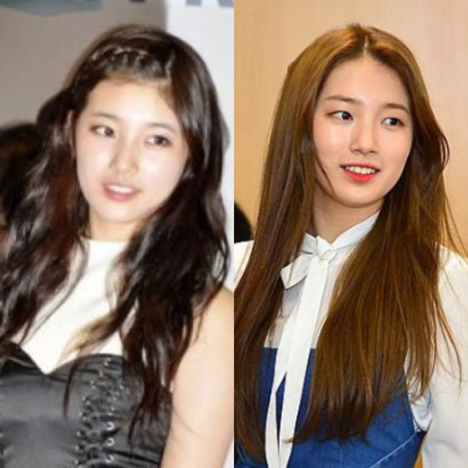 수지, 최근 미모의 비결은? '이마왁싱'..확실히 달라 < 연예 < 뉴스 < 기사본문 - 코리아데일리