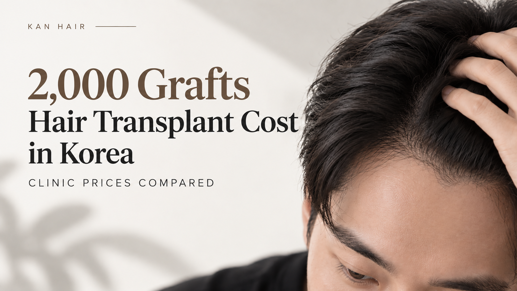 2,000 grafts hair transplant cost in Korea