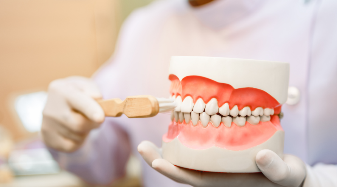 Dental Bridge vs Implant Longevity: Comparing Lifespans & Outcomes