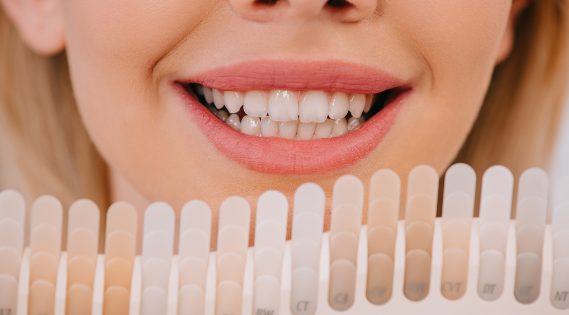 Reshaping Teeth for a Better Smile: Complete Guide 2025