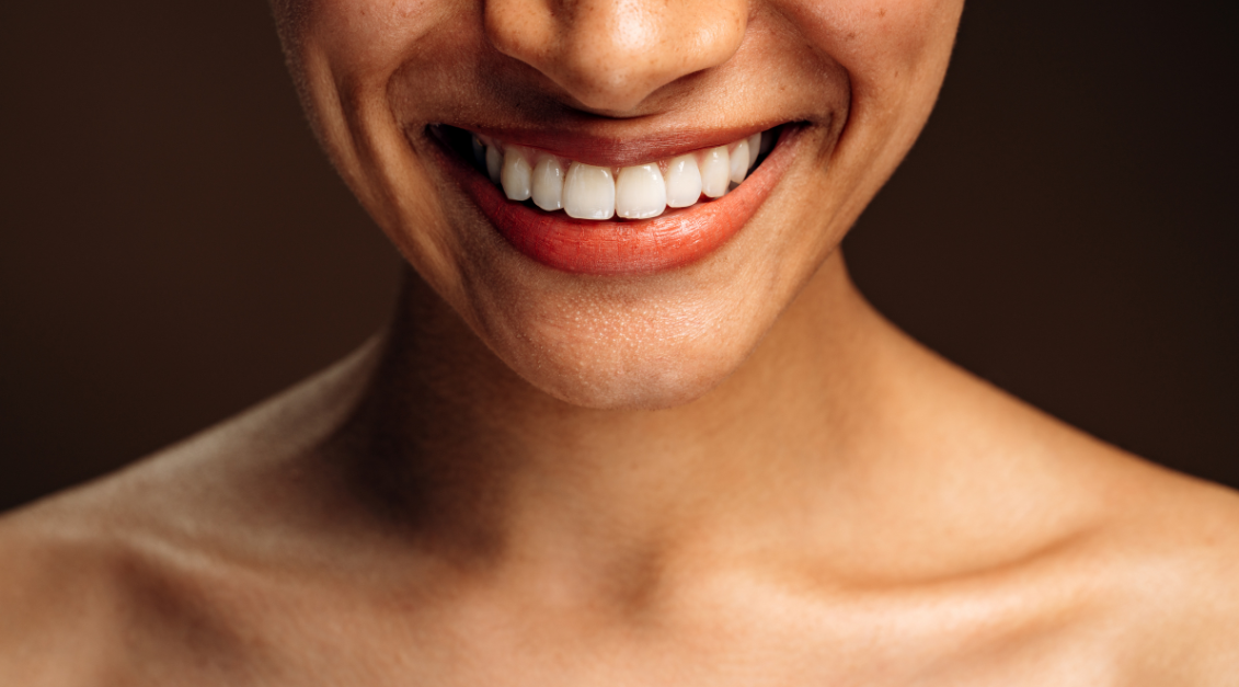 Esta es la mejor manera de blanquear los dientes