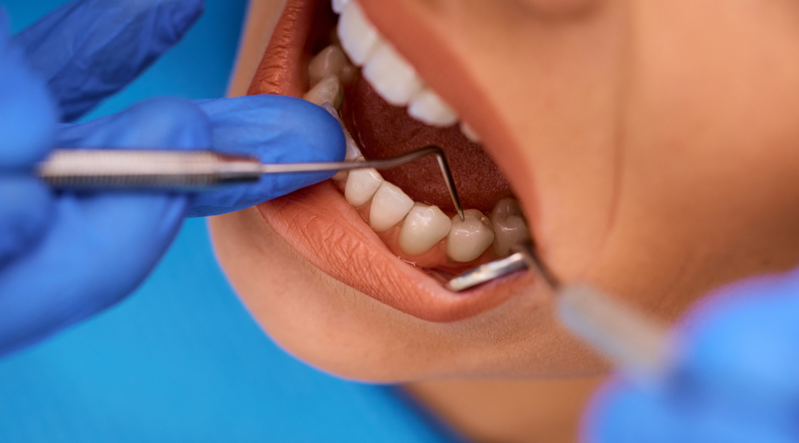 Destinos de turismo dental comparados: por qué México lidera el camino